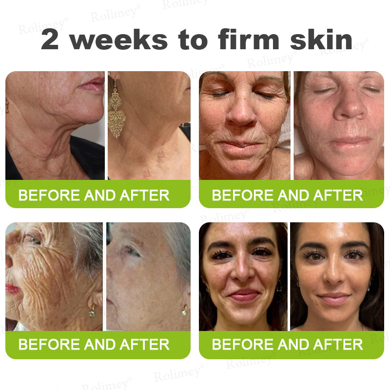🪄Rolimey® Botox & Vita-A Retinol Shot Wrinkle-Lift Tightening stick