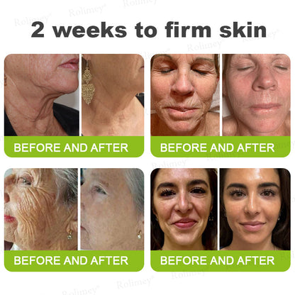 🪄Rolimey® Botox & Vita-A Retinol Shot Wrinkle-Lift Tightening stick