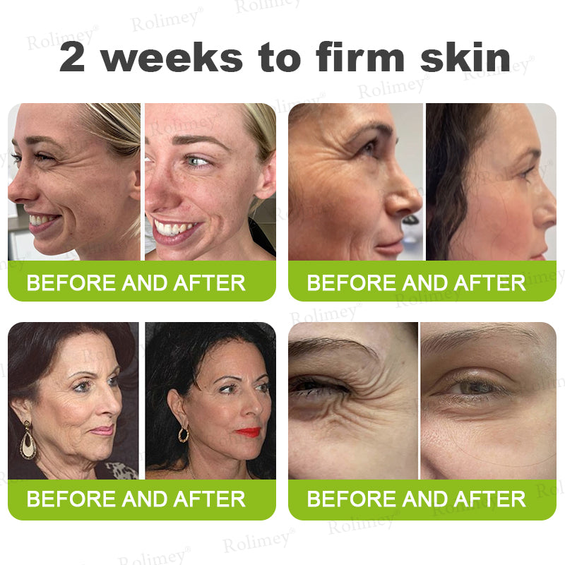 🪄Rolimey® Botox & Vita-A Retinol Shot Wrinkle-Lift Tightening stick