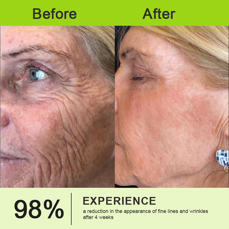 🪄Rolimey® Botox & Vita-A Retinol Shot Wrinkle-Lift Tightening stick
