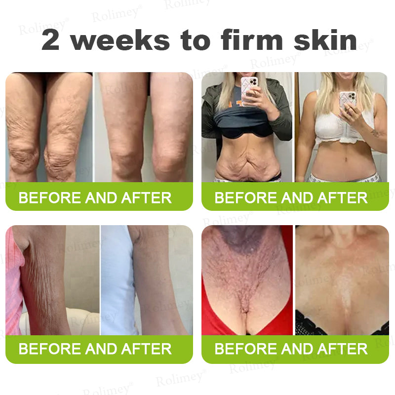 🪄Rolimey® Botox & Vita-A Retinol Shot Wrinkle-Lift Tightening stick