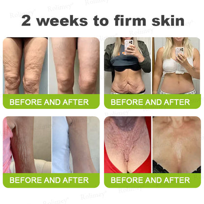 🪄Rolimey® Botox & Vita-A Retinol Shot Wrinkle-Lift Tightening stick