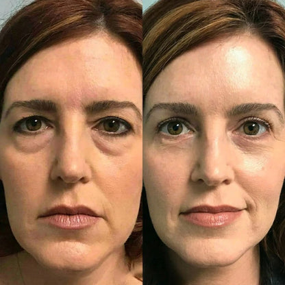 Rolimey® Botox & Vita A Retinol Shot Wrinkle-Lift Tightening cream