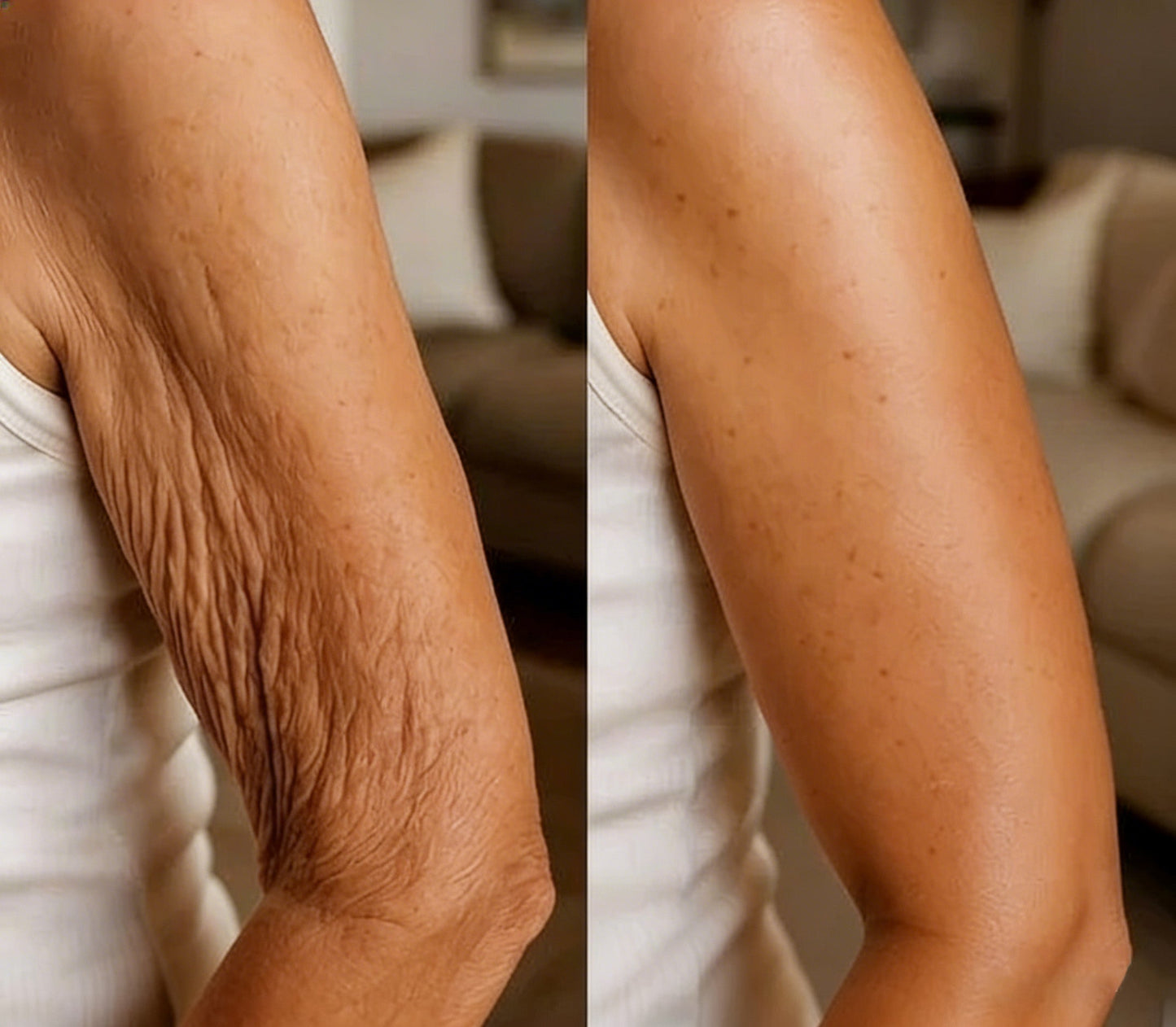 Rolimey® Botox & Vita A Retinol Shot Wrinkle-Lift Tightening cream